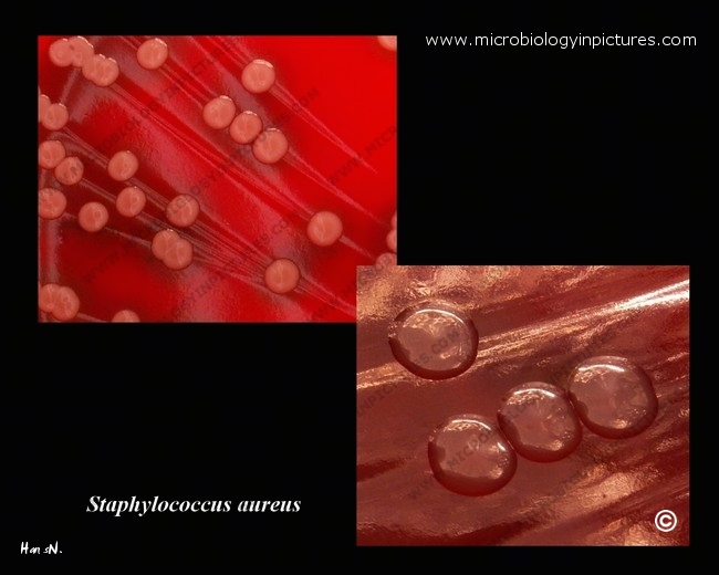 s.aureus detail of colonies